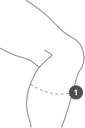 Mesures Figure